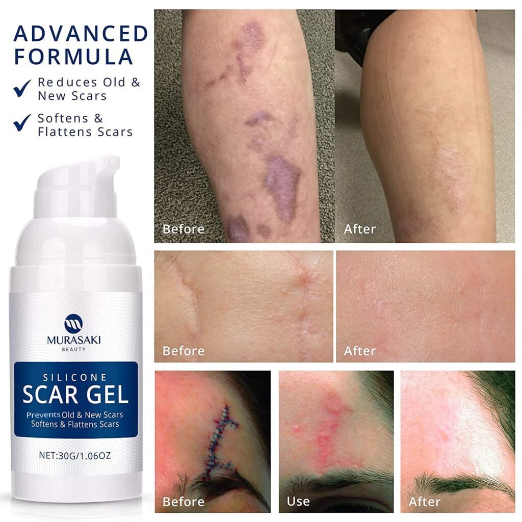 100% Silicone Scar Gel Scar Cream - Advanced Scar Gel for Surgical Scars, C-Section, Stretch Marks, Acne, Injury, Burns, Keloids, Old and New Scars 1.06oz(30g) (Maximum Strength 100% Silicone)